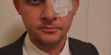 Kitanović tvrdi da je morao na ispiranje oka nakon tuče u Skupštini Srbije