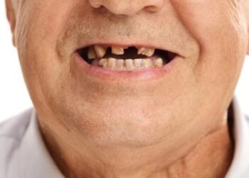 Nacija krezuba i bezuba uprkos potrošnji više stotina miliona evra za stomatološke usluge