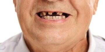 Nacija krezuba i bezuba uprkos potrošnji više stotina miliona evra za stomatološke usluge