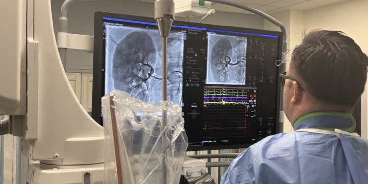 U KC Niš po prvi put urađena interventna procedura renalne denervacije