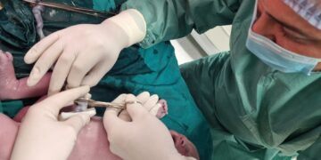 Istorijski trenutak u leskovačkoj bolnici: Prvi porođaj uz prisustvo oca